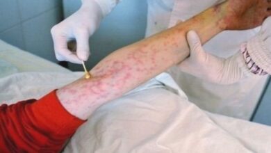 In numbers... Officials reveal the statistics of AIDS patients for the year 2022 - Al-Hiwar Al-Jazairia