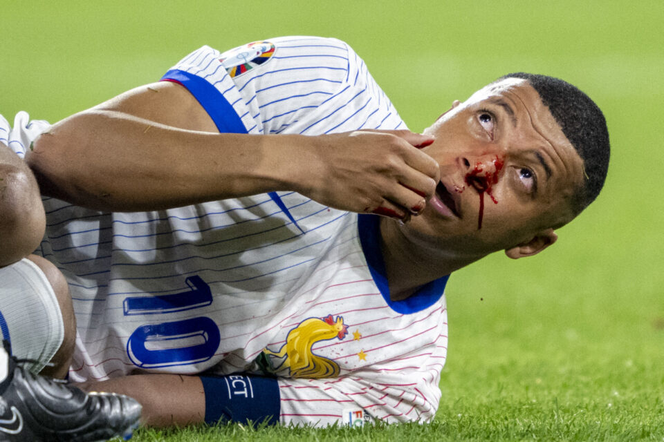Mbappe will not leave Euro 2024 and will wear a mask over his nose - the new Algeria