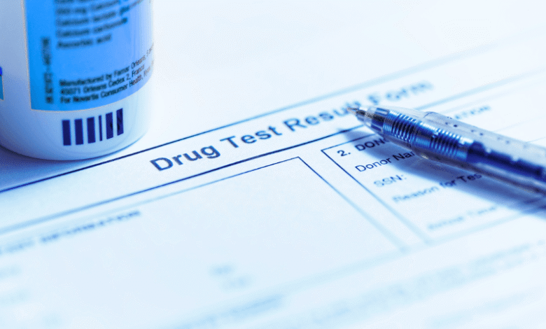 Drug detection tests for employment expire after 3 months - New Algeria